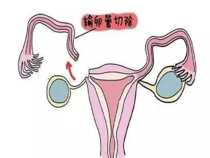 【安全捍卫】深圳公立医院供卵试管中心排名